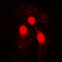 SMAD3 Antibody - Immunofluorescent analysis of SMAD3 (pS204) staining in HeLa cells. Formalin-fixed cells were permeabilized with 0.1% Triton X-100 in TBS for 5-10 minutes and blocked with 3% BSA-PBS for 30 minutes at room temperature. Cells were probed with the primary antibody in 3% BSA-PBS and incubated overnight at 4 C in a humidified chamber. Cells were washed with PBST and incubated with a DyLight 594-conjugated secondary antibody (red) in PBS at room temperature in the dark. DAPI was used to stain the cell nuclei (blue).