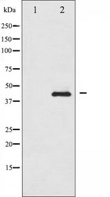 SMAD3 Antibody - Western blot analysis of Smad3 phosphorylation expression in Jurkat whole cells lysates. The lane on the left is treated with the antigen-specific peptide.
