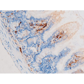 SMAD3 Antibody - 1:200 staining mouse intestinal tissue by IHC-P. The tissue was formaldehyde fixed and a heat mediated antigen retrieval step in citrate buffer was performed. The tissue was then blocked and incubated with the antibody for 1.5 hours at 22°C. An HRP conjugated goat anti-rabbit antibody was used as the secondary.