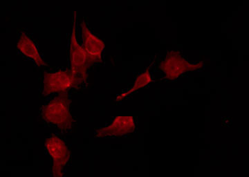SMAD3 Antibody - Staining NIH-3T3 cells by IF/ICC. The samples were fixed with PFA and permeabilized in 0.1% Triton X-100, then blocked in 10% serum for 45 min at 25°C. The primary antibody was diluted at 1:200 and incubated with the sample for 1 hour at 37°C. An Alexa Fluor 594 conjugated goat anti-rabbit IgG (H+L) Ab, diluted at 1/600, was used as the secondary antibody.