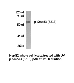 SMAD3 Antibody - Western blot of p-Smad3 (S213) pAb in extracts from HepG2 (treated with UV) cells.