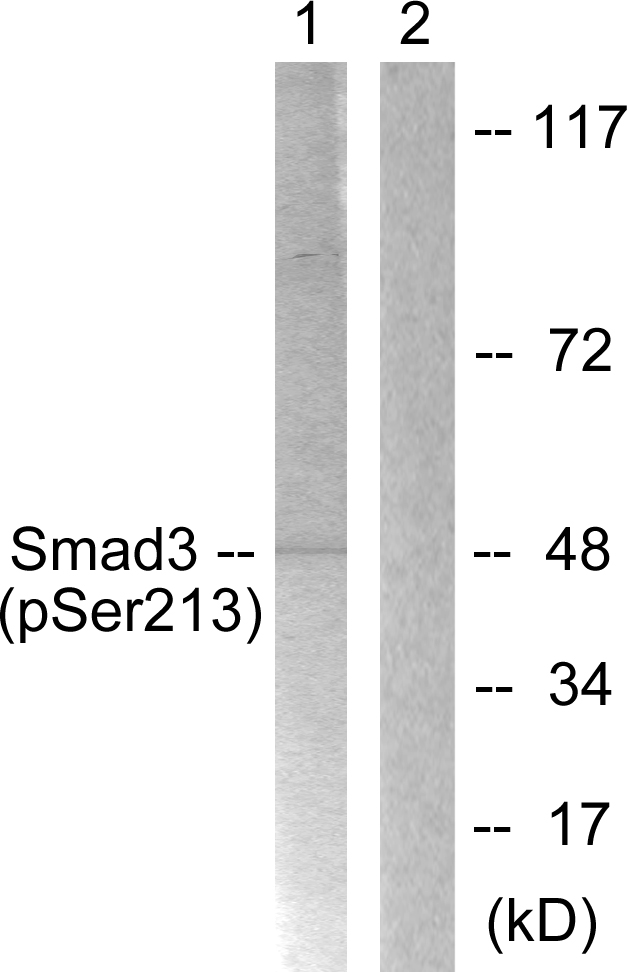 SMAD3 Antibody - Western blot analysis of lysates from HT29 cells, using Smad3 (Phospho-Ser213) Antibody. The lane on the right is blocked with the phospho peptide.