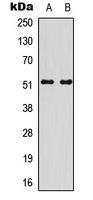 SMAD3 Antibody - Western blot analysis of SMAD3 (pS213) expression in A549 (A); Jurkat (B) whole cell lysates.