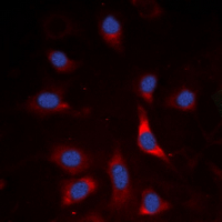 SMAD3 Antibody - Immunofluorescent analysis of SMAD3 (pS213) staining in A549 cells. Formalin-fixed cells were permeabilized with 0.1% Triton X-100 in TBS for 5-10 minutes and blocked with 3% BSA-PBS for 30 minutes at room temperature. Cells were probed with the primary antibody in 3% BSA-PBS and incubated overnight at 4 deg C in a humidified chamber. Cells were washed with PBST and incubated with a DyLight 594-conjugated secondary antibody (red) in PBS at room temperature in the dark. DAPI was used to stain the cell nuclei (blue).