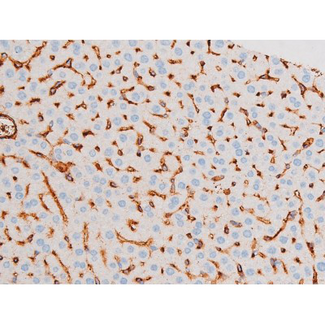 SMAD3 Antibody - 1:200 staining mouse liver tissue by IHC-P. The tissue was formaldehyde fixed and a heat mediated antigen retrieval step in citrate buffer was performed. The tissue was then blocked and incubated with the antibody for 1.5 hours at 22°C. An HRP conjugated goat anti-rabbit antibody was used as the secondary.
