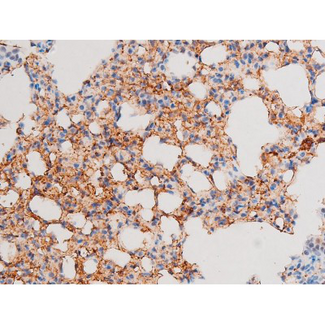 SMAD3 Antibody - 1:200 staining mouse lung tissue by IHC-P. The tissue was formaldehyde fixed and a heat mediated antigen retrieval step in citrate buffer was performed. The tissue was then blocked and incubated with the antibody for 1.5 hours at 22°C. An HRP conjugated goat anti-rabbit antibody was used as the secondary.