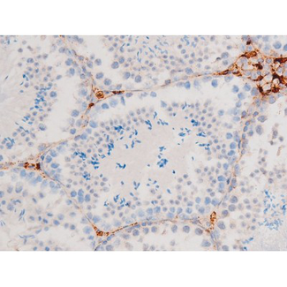 SMAD3 Antibody - 1:200 staining mouse testis tissue by IHC-P. The tissue was formaldehyde fixed and a heat mediated antigen retrieval step in citrate buffer was performed. The tissue was then blocked and incubated with the antibody for 1.5 hours at 22°C. An HRP conjugated goat anti-rabbit antibody was used as the secondary.