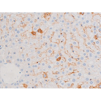 SMAD3 Antibody - 1:200 staining rat liver tissue by IHC-P. The tissue was formaldehyde fixed and a heat mediated antigen retrieval step in citrate buffer was performed. The tissue was then blocked and incubated with the antibody for 1.5 hours at 22°C. An HRP conjugated goat anti-rabbit antibody was used as the secondary.
