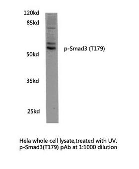 SMAD3 Antibody - Western blot of p-Smad3 (T179) pAb in extracts from UV-HeLa cells.