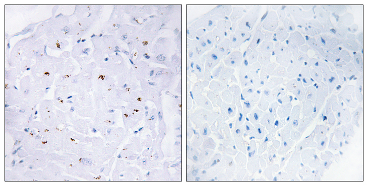 SMAD3 Antibody - Immunohistochemistry analysis of paraffin-embedded human heart, using Smad3 (Phospho-Thr179) Antibody. The picture on the right is blocked with the phospho peptide.