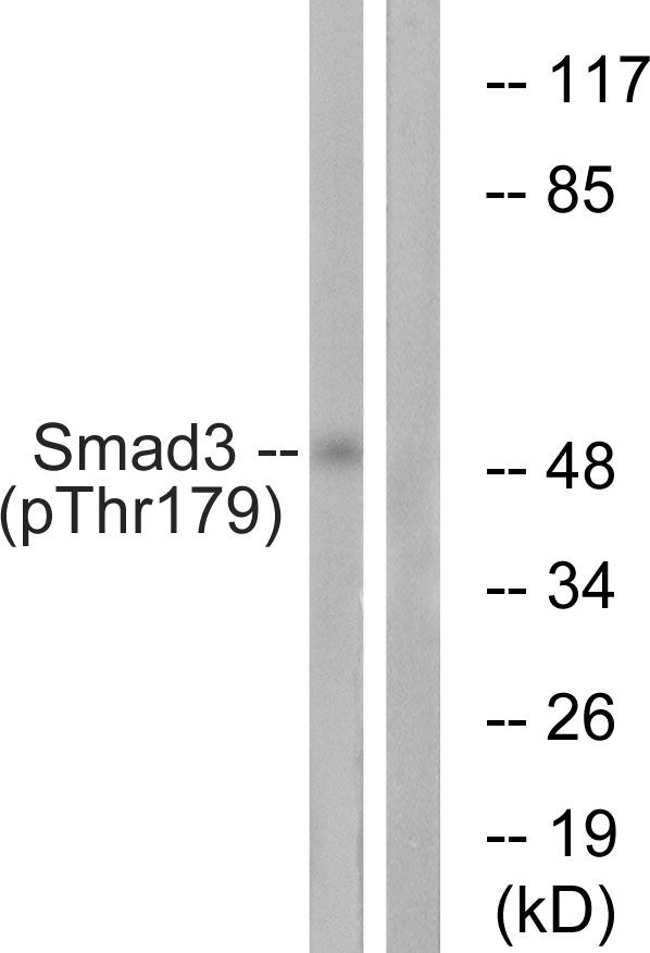 SMAD3 Antibody - Western blot analysis of lysates from HeLa cells treated with TNF 20ng/ml 2', using Smad3 (Phospho-Thr179) Antibody. The lane on the right is blocked with the phospho peptide.