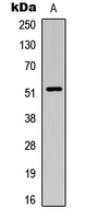 SMAD3 Antibody - Western blot analysis of SMAD3 (pT179) expression in HeLa (A) whole cell lysates.