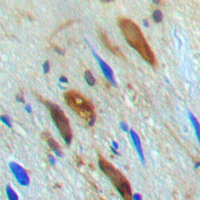 SMAD3 Antibody - Immunohistochemical analysis of SMAD3 (pT179) staining in human brain formalin fixed paraffin embedded tissue section. The section was pre-treated using heat mediated antigen retrieval with sodium citrate buffer (pH 6.0). The section was then incubated with the antibody at room temperature and detected using an HRP-conjugated compact polymer system. DAB was used as the chromogen. The section was then counterstained with hematoxylin and mounted with DPX.