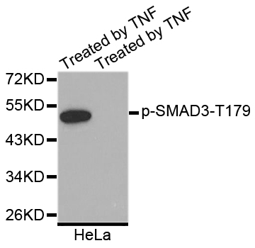 SMAD3 Antibody - Western blot blot of extracts of HeLa cell line, using Phospho-SMAD3-T179 antibody. The lane on the right is treated with the antigen-specific peptide.