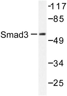 SMAD3 Antibody - Western blot of Smad3 (P417) pAb in extracts from 293 cells treated with UV 5'.
