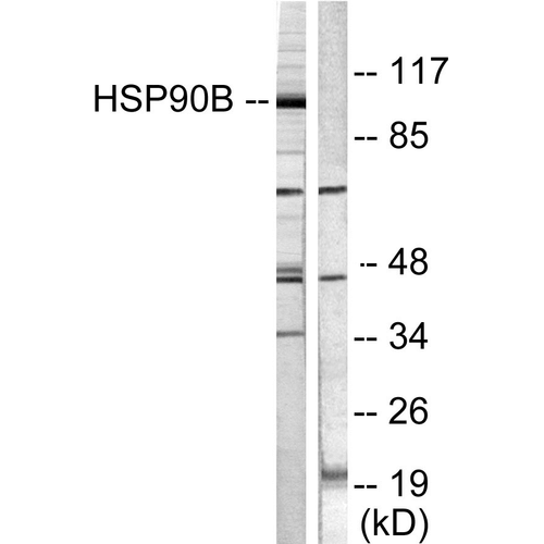 SMAD3 Antibody - Western blot analysis of Human Cervical cancer cell line (HeLa) lysate showing detection of ~90kDa Hsp90 beta protein using Rabbit Anti-Hsp90 beta Polyclonal Antibody (the antibody6). Lane 1: Human HeLa cells treated with TNF-alpha (20ng/ml, 30mins). Lane 2: Untreated. Primary Antibody: Rabbit Anti-Hsp90 beta Polyclonal Antibody (the antibody6) at 1:1000. Predicted/Observed Size: ~90kDa.