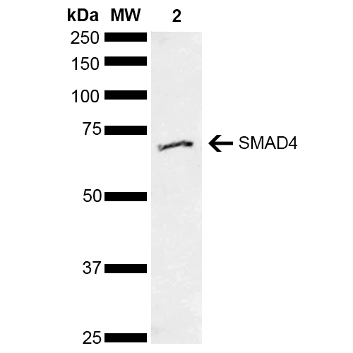 SMAD4 Antibody - Western blot analysis of Human Cervical cancer cell line (HeLa) lysate showing detection of ~60.4 kDa SMAD4 protein using Rabbit Anti-SMAD4 Polyclonal Antibody. Lane 1: Molecular Weight Ladder (MW). Lane 2: Cervical Cancer cell line (HeLa) lysate. Load: 10 µg. Block: 5% Skim Milk in 1X TBST. Primary Antibody: Rabbit Anti-SMAD4 Polyclonal Antibody  at 1:1000 for 2 hours at RT. Secondary Antibody: Goat Anti-Rabbit HRP:IgG at 1:3000 for 1 hour at RT. Color Development: ECL solution for 5 min at RT. Predicted/Observed Size: ~60.4 kDa.