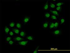 SMAD4 Antibody - Immunofluorescence of monoclonal antibody to SMAD4 on HeLa cell. [antibody concentration 10 ug/ml]