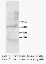 SMAD4 Antibody - WB of SMAD4 antibody. Lane 1: Rat Brain Tissue Lysate. Lane 2: Rat Brain Tissue Lysate..