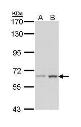 SMAD4 Antibody - Sample (30 ug of whole cell lysate). A: Hela. B: Hep G2. 7.5% SDS PAGE. SMAD4 antibody diluted at 1:1000. 