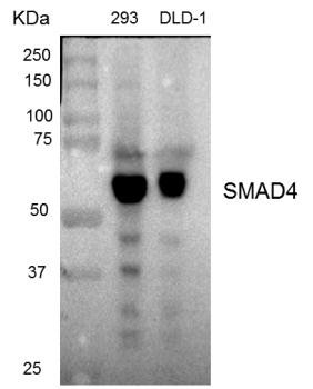 SMAD4 Antibody - Western blot analysis of extracts from 293 cells and DLD-1 cells.