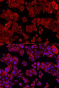 SMAD4 Antibody - Immunofluorescence images of SW480 cells showing nuclear and cytoplasmic localization with SMAD4 Antibody 1:200 (top, red).