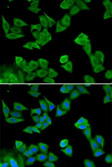 SMAD4 Antibody - Immunofluorescence analysis of HeLa cells.