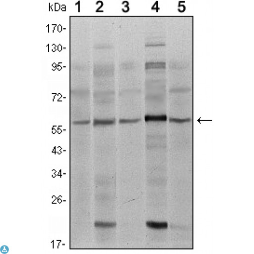 SMAD4 Antibody - Western Blot (WB) analysis using Smad4 Monoclonal Antibody against A431 (1), SK-N-SH (2), K562 (3), HepG2 (4) and HUVE12 (5) cell lysate.