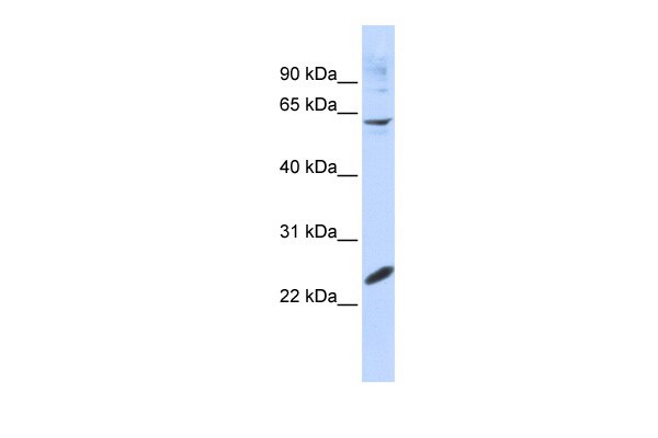 SMAD4 Antibody - SMAD4 antibody western blot of 293T cell lysate.