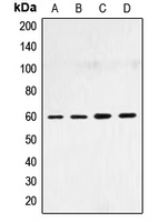 SMAD4 Antibody - Western blot analysis of SMAD4 expression in HepG2 (A); HeLa (B); NIH3T3 (C); COS7 (D) whole cell lysates.