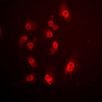 SMAD4 Antibody - Immunofluorescent analysis of SMAD4 staining in HeLa cells. Formalin-fixed cells were permeabilized with 0.1% Triton X-100 in TBS for 5-10 minutes and blocked with 3% BSA-PBS for 30 minutes at room temperature. Cells were probed with the primary antibody in 3% BSA-PBS and incubated overnight at 4 C in a humidified chamber. Cells were washed with PBST and incubated with a DyLight 594-conjugated secondary antibody (red) in PBS at room temperature in the dark. DAPI was used to stain the cell nuclei (blue).