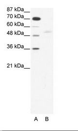 SMAD5 Antibody - A: Marker, B: HepG2 Cell Lysate.  This image was taken for the unconjugated form of this product. Other forms have not been tested.