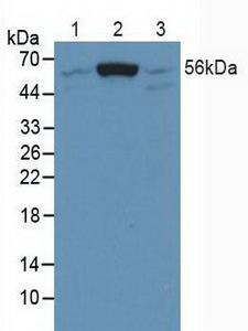 SMAD5 Antibody - Western Blot; Sample: Lane1: Human K562 Cells; Lane2: Human Hela Cells; Lane3: Human Jurkat Cells.