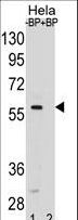 SMAD5 Antibody - SMAD5 Antibody pre-incubated without(lane 1) and with(lane 2) blocking peptide in HeLa cell line lysate. SMAD5 Antibody (arrow) was detected using the purified antibody.