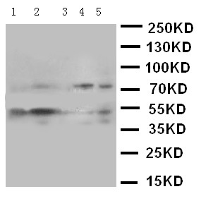SMAD5 Antibody - WB of SMAD5 antibody. Lane 1: K562 Cell Lysate. Lane 2: JURKAT Cell Lysate. Lane 3: PC 1-2 Cell Lysate. Lane 4: HELA Cell Lysate. Lane 5: SMMC Cell Lysate.