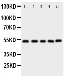 SMAD5 Antibody - Anti-SMAD5 antibody, Western blotting All lanes: Anti SMAD5 at 0.5ug/ml Lane 1: K562 Whole Cell Lysate at 40ug Lane 2: JURKAT Whole Cell Lysate at 40ug Lane 3: PC 1-2 Whole Cell Lysate at 40ug Lane 4: HELA Whole Cell Lysate at 40ug Lane 5: SMMC Whole Cell Lysate at 40ug Predicted bind size: 52 KD Observed bind size: 52KD