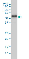 SMAD5 Antibody - SMAD5 monoclonal antibody (M01), clone 2D7 Western Blot analysis of SMAD5 expression in HeLa NE.