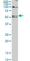 SMAD5 Antibody - SMAD5 monoclonal antibody (M01), clone 2D7. Western Blot analysis of SMAD5 expression in Jurkat.