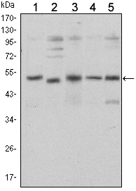 SMAD5 Antibody - Western blot using SMAD5 mouse monoclonal antibody against HeLa (1), SK-N-SH (2), PC-12 (3), Jurkat (4), and K562 (5) cell lysate.