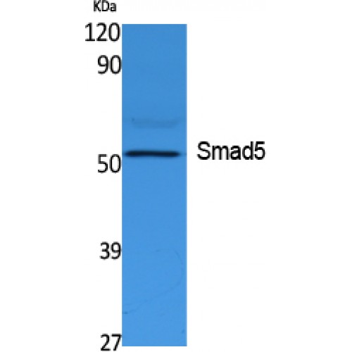 SMAD5 Antibody - Western blot of Smad5 antibody