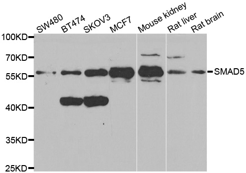 SMAD5 Antibody - Western blot analysis of extracts of various cell lines.