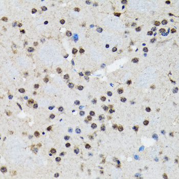 SMAD5 Antibody - Immunohistochemistry of paraffin-embedded rat brain tissue.