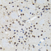 SMAD5 Antibody - Immunohistochemistry of paraffin-embedded rat brain tissue.