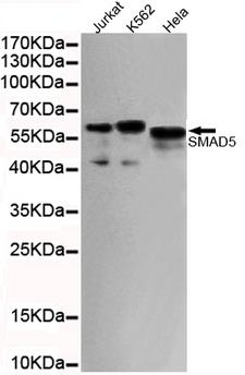 SMAD5 Antibody - Western blot detection of SMAD5 (C-terminus) in HeLa, Jurkat and K562 cell lysates using SMAD5 (C-terminus) mouse monoclonal antibody (1:1000 dilution). Predicted band size: 52KDa. Observed band size:60KDa.