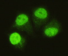 SMAD5 Antibody - Immunocytochemistry of HeLa cells using anti-SMAD5 (C-terminus) mouse monoclonal antibody diluted 1:75.