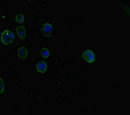 SMAD5 Antibody - Immunofluorescent analysis of MCF7 cells diluted at 1:100 and Alexa Fluor 488-congugated AffiniPure Goat Anti-Rabbit IgG(H+L)