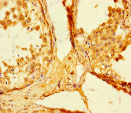 SMAD5 Antibody - Immunohistochemistry of paraffin-embedded human testis tissue at dilution 1:100