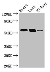 SMAD5 Antibody - Western Blot Positive WB detected in:Mouse heart tissue,Mouse lung tissue,Mouse kidney tissue All Lanes: SMAD5 antibody at 3ug/ml Secondary Goat polyclonal to rabbit IgG at 1/50000 dilution Predicted band size: 53 kDa Observed band size: 53 kDa