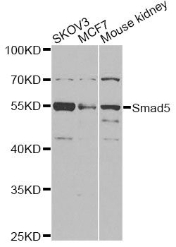 SMAD5 Antibody - Western blot analysis of extracts of various cell lines, using Smad5 antibody at 1:1000 dilution. The secondary antibody used was an HRP Goat Anti-Rabbit IgG (H+L) at 1:10000 dilution. Lysates were loaded 25ug per lane and 3% nonfat dry milk in TBST was used for blocking. An ECL Kit was used for detection and the exposure time was 30s.
