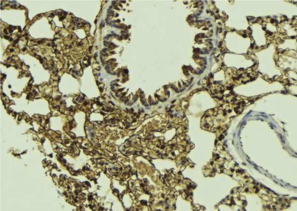 SMAD5 Antibody - 1:100 staining mouse lung tissue by IHC-P. The sample was formaldehyde fixed and a heat mediated antigen retrieval step in citrate buffer was performed. The sample was then blocked and incubated with the antibody for 1.5 hours at 22°C. An HRP conjugated goat anti-rabbit antibody was used as the secondary.